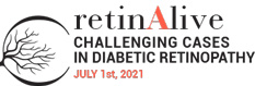 retinAlive Logo