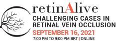 retinAlive Logo